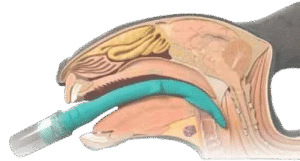 Mascarillas Supraglóticas para Conejos